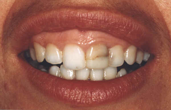 fotografia original sem retoques